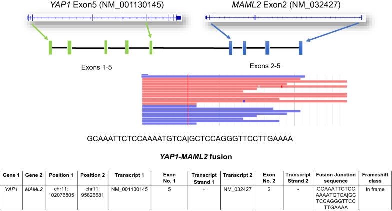 【佳学基因检测】脑干神经瘤NF2基因检测结果阴性是怎么找到致病基因突变的？ 